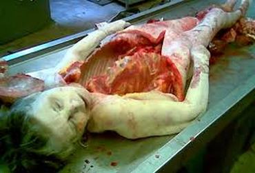 Typical Autopsy - Autopsy Project
